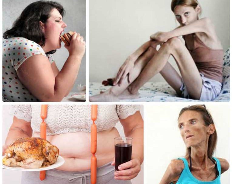 Διατροφικές διαταραχές